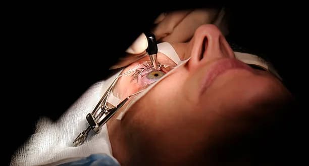 Points To Consider Before Spending On LASIK Surgery Cost In Delhi